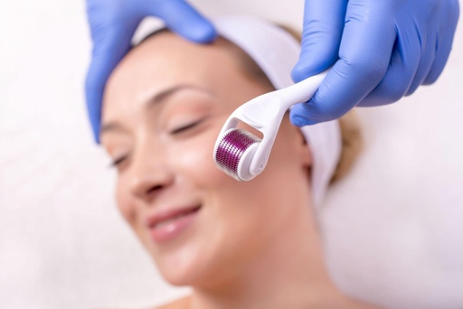 Microneedling Therapy